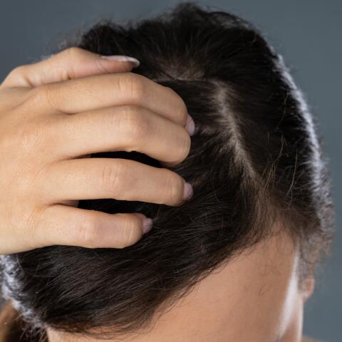 AD_ATOPIE_WOMAN-SCRATCHING-SCALP_SQUARE_2021 480*480