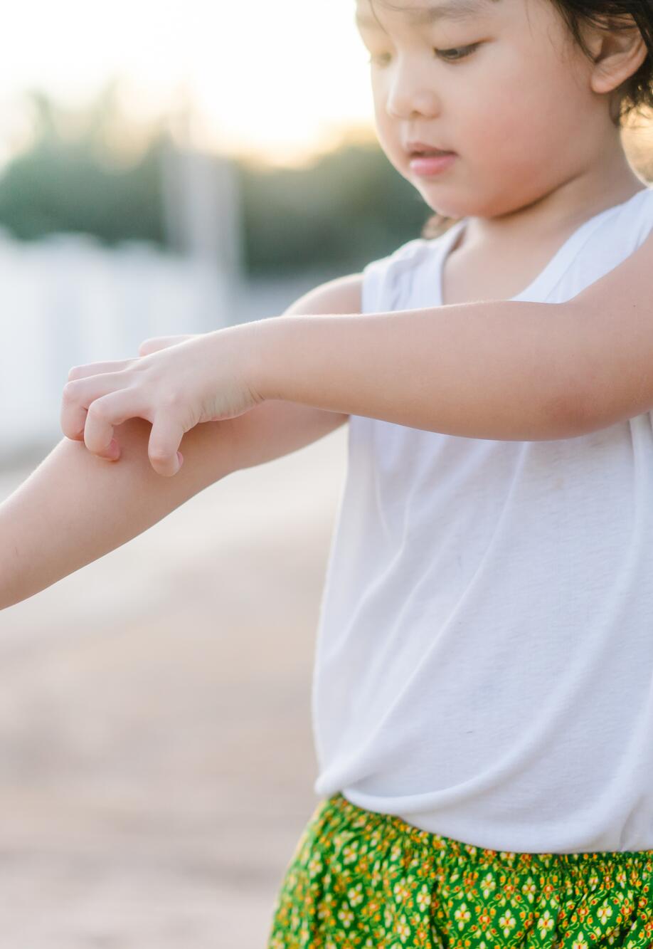 AD_ATOPIE_LITTLE-GIRL-SCRATCHING-ARM_LARGE_2021 472x472
