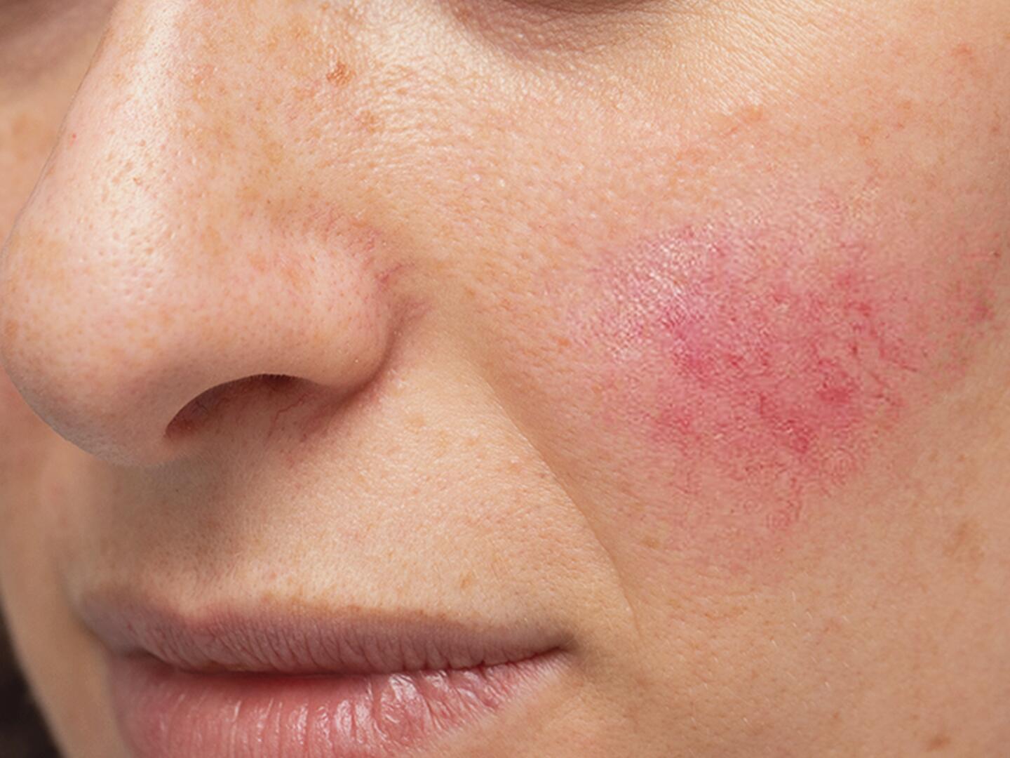 Überempfindliche & Allergische Haut Eau Thermale Avène