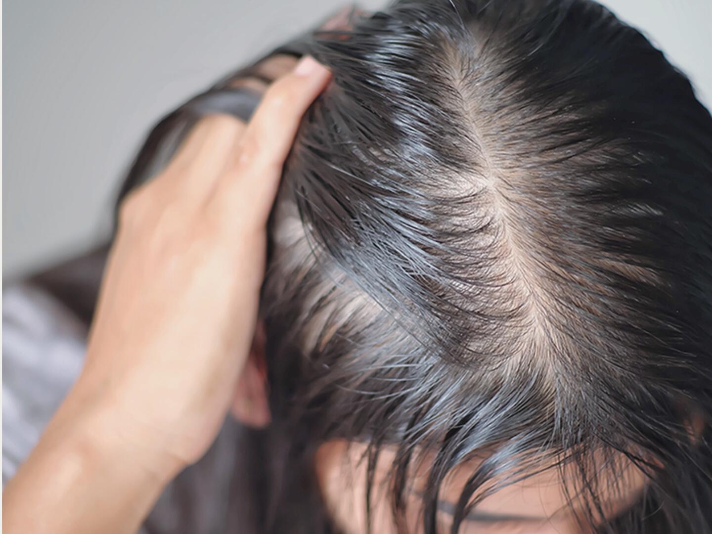 DU_Geheimratsecken_bei_der_Frau_textmodul2