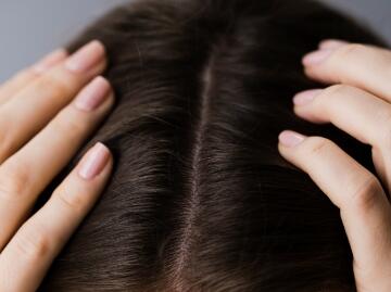 kl_mag_happy-skin_hair-loss_visual_header