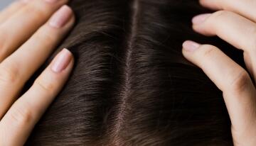 Cuir chevelu qui gratte et perte de cheveux | Klorane