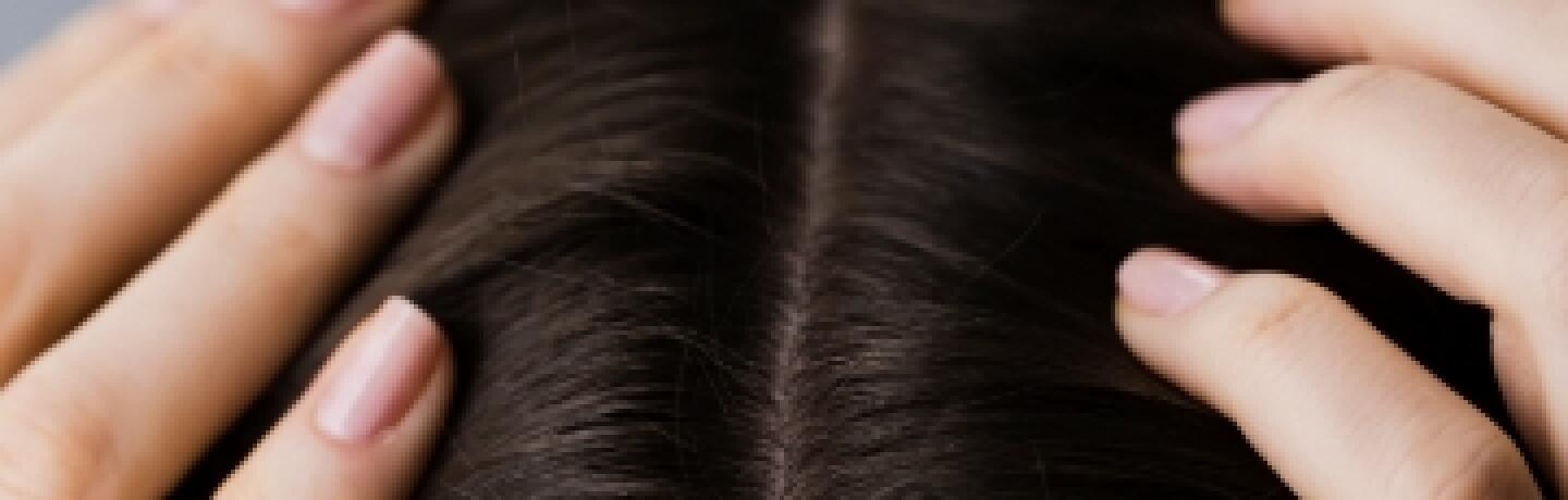 kl_mag_happy-skin_hair-loss_visual_header-1440x460-KL-FR-DE-chute