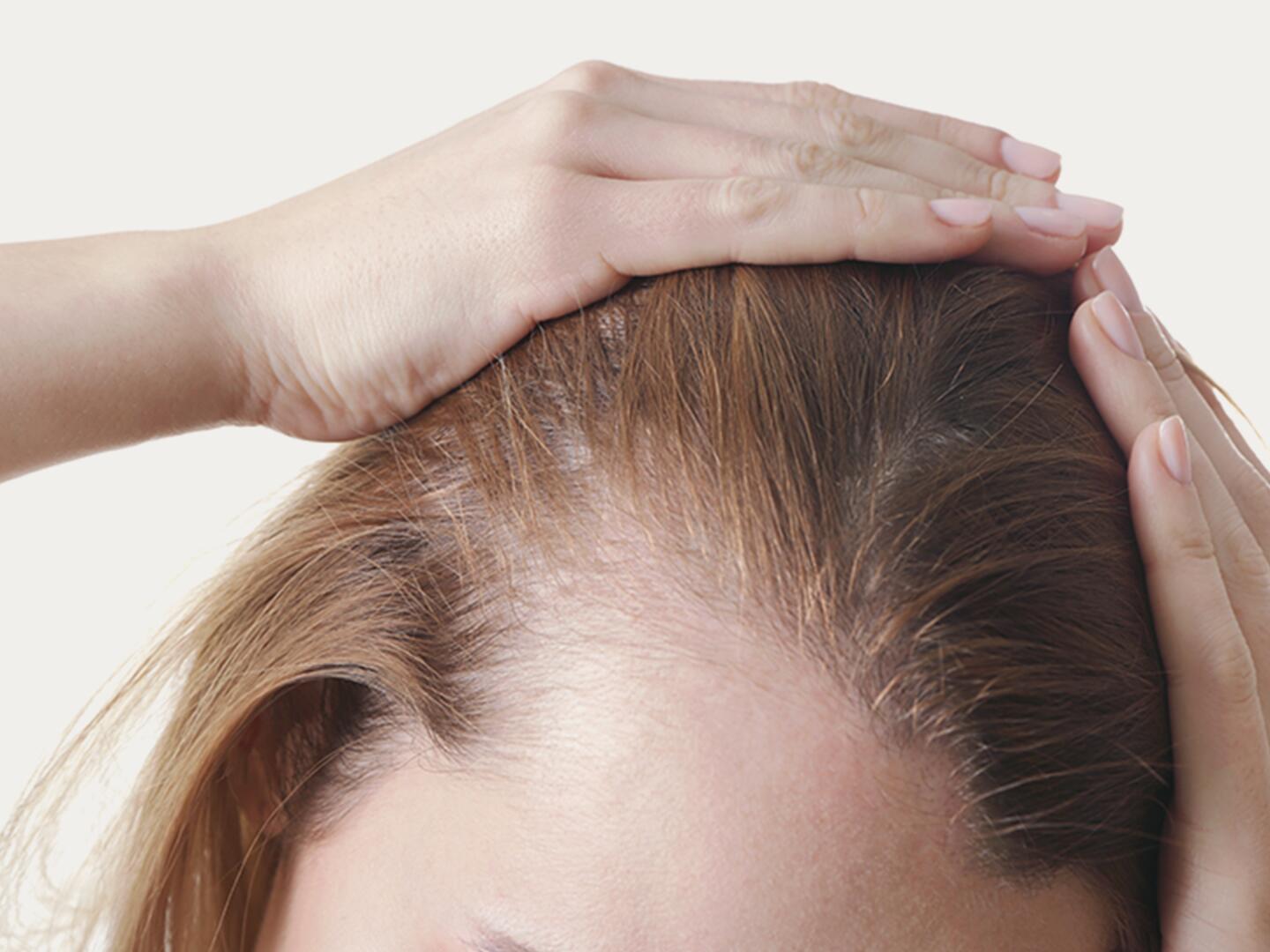 DU_Geheimratsecken_bei_der_Frau_textmodul3