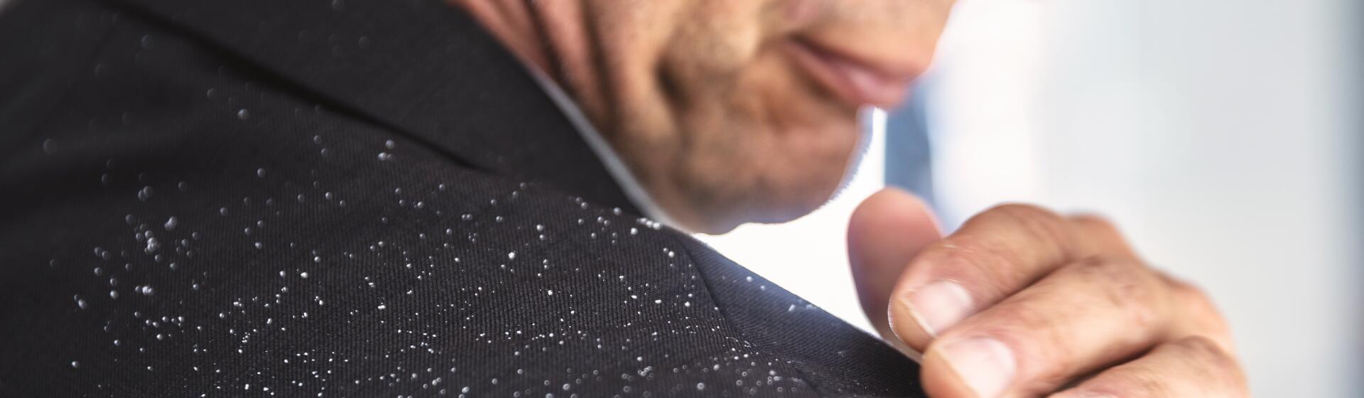 Dandruff in the hair: causes & treatments