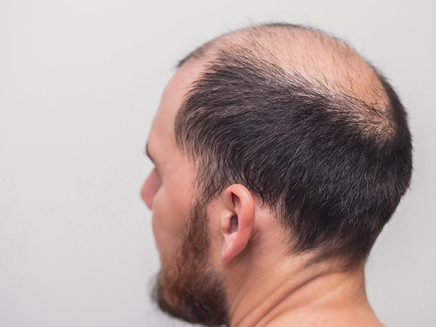 DU_Shampoo_gegen_Haarausfalle_textmodul2