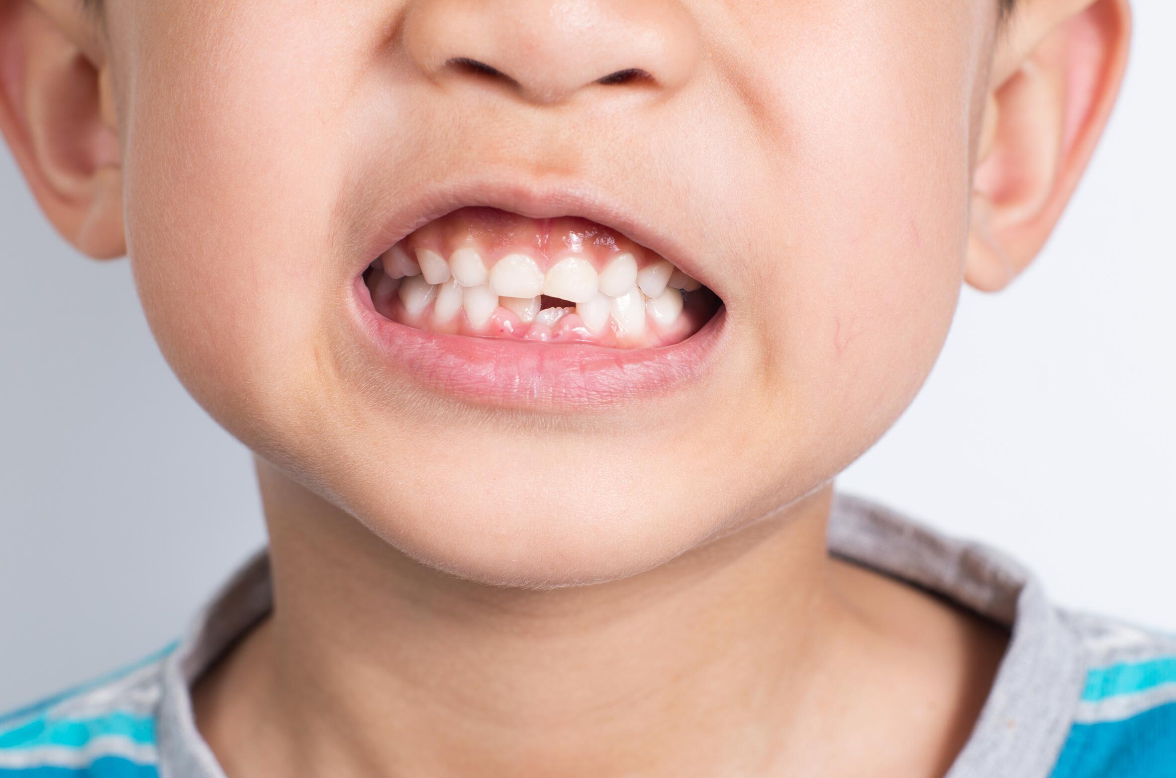 OC_ImageStock_Boy_Teeth_Smile_2018