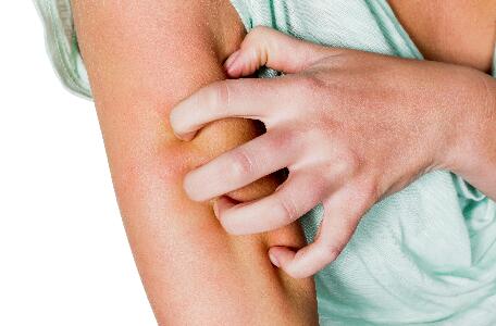 du_neurodermitis_silo_psoriasis_plaque