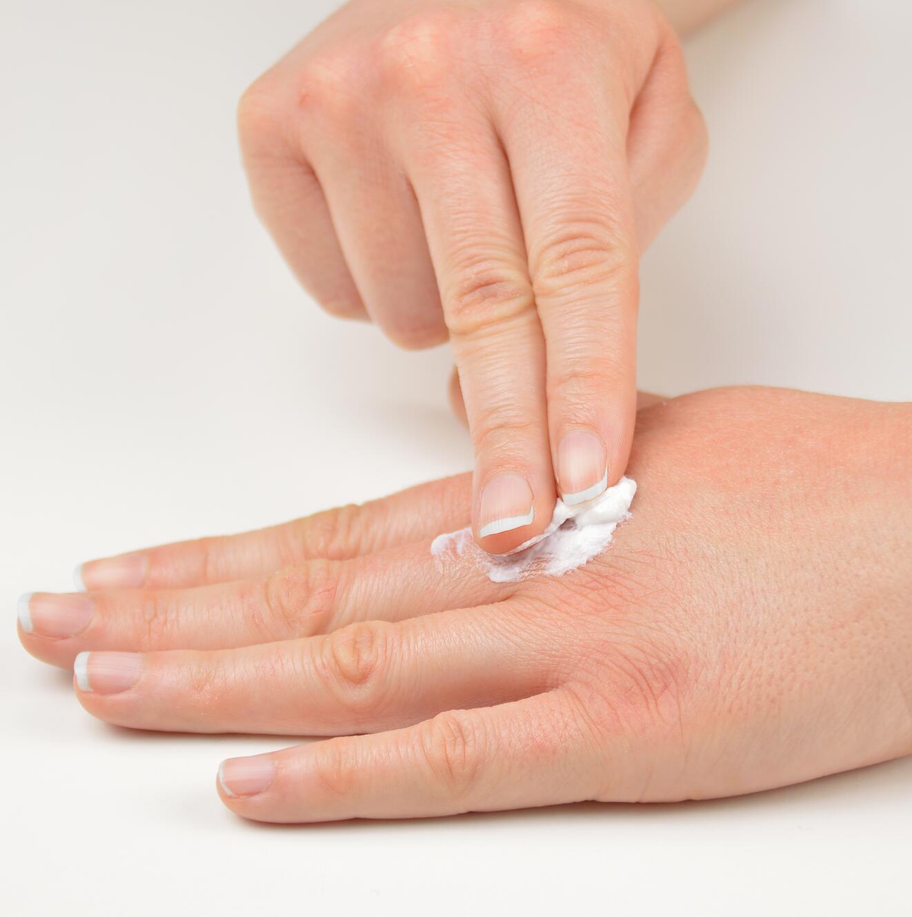 Lenire una riacutizzazione di eczema da contatto
