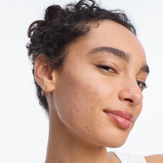 Peaux grasses ou à tendance acnéique