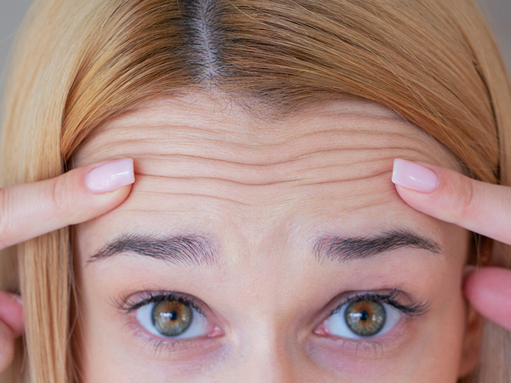 AV_Anti-Aging_stirnfalten_bild_textmodul_03_720x540