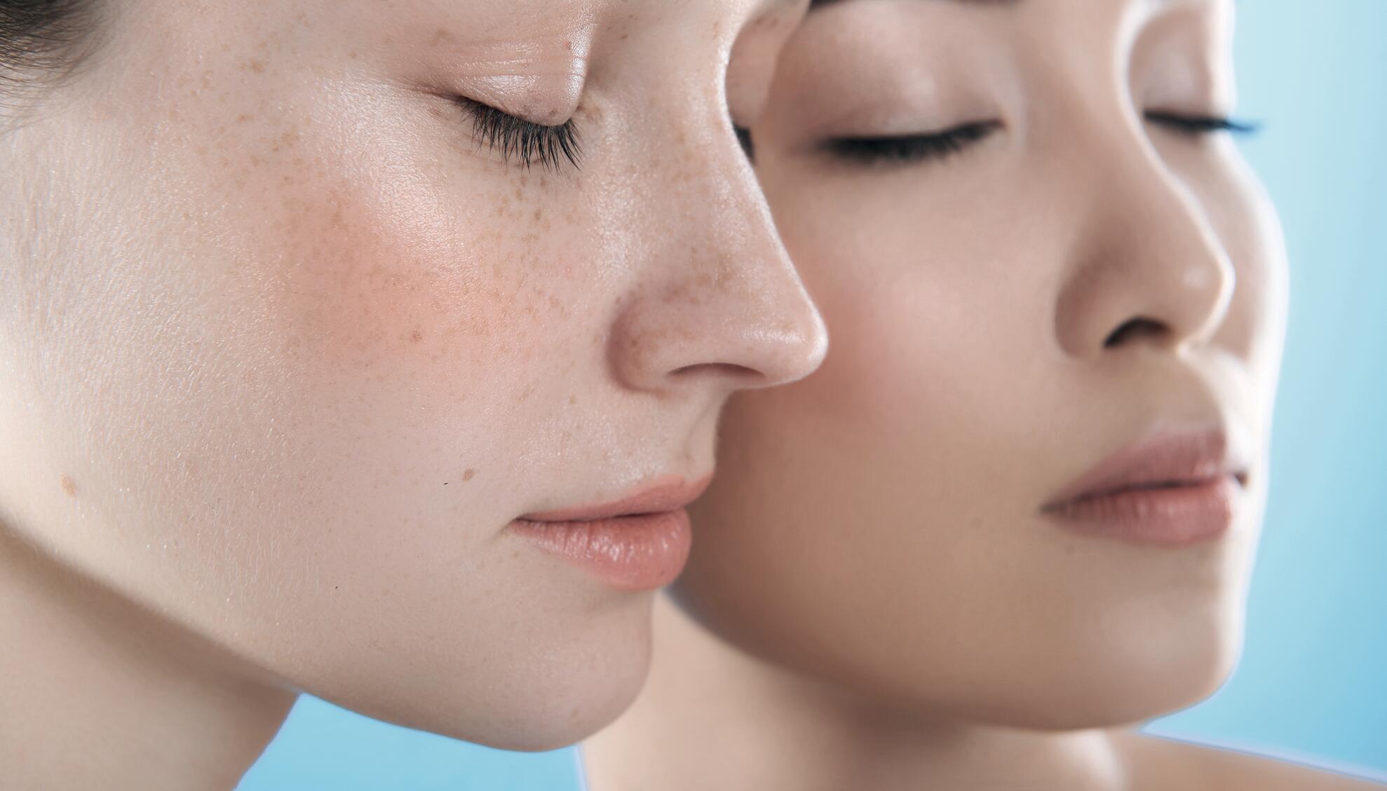 Comprendre et soigner les rougeurs du visage | A-DERMA