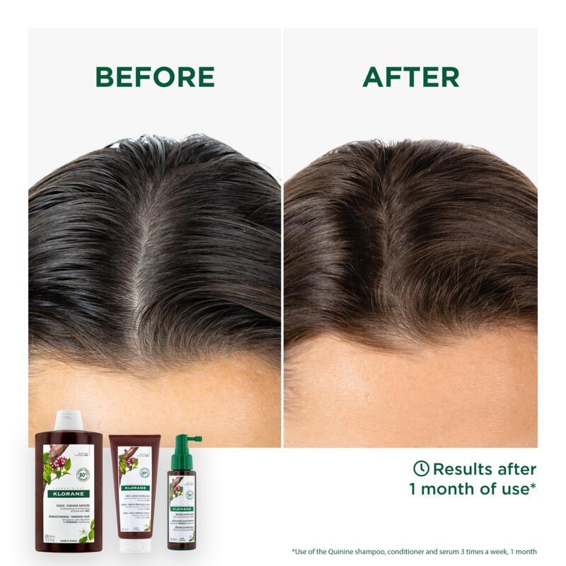 Strengthening Shampoo with Quinine & Organic Edelweiss - Thinning hair