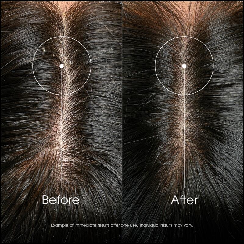 ANTI-DANDRUFF Rebalancing & Treating Shampoo