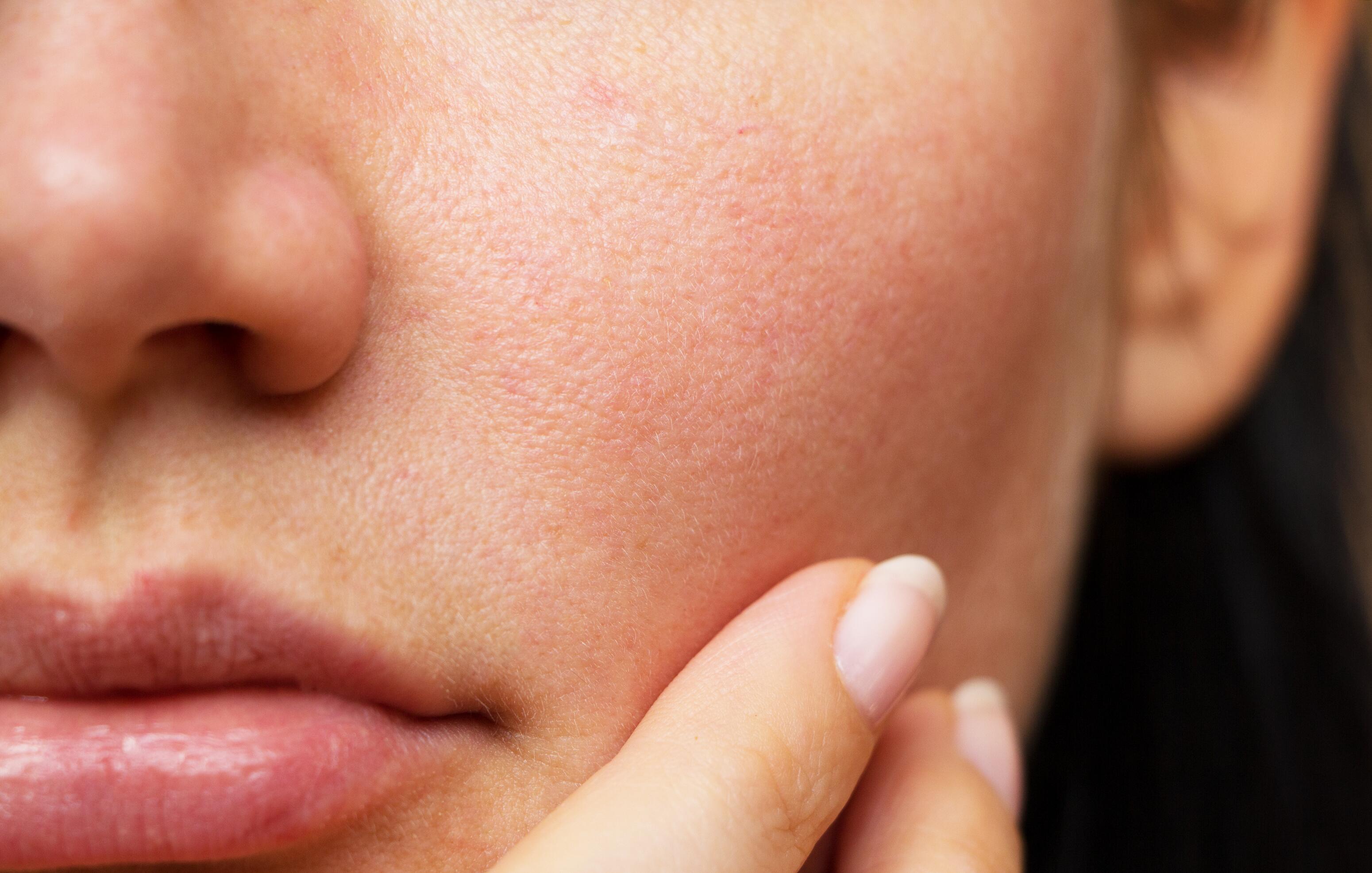 du_article_mixed-skin_header