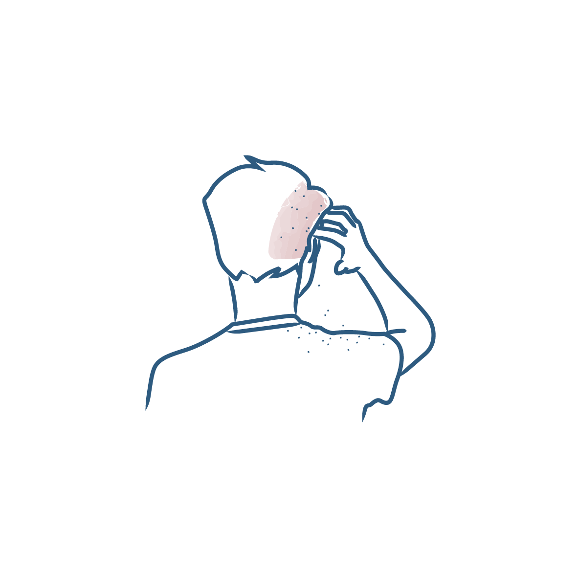 Hilsettä ehkäisevä DS