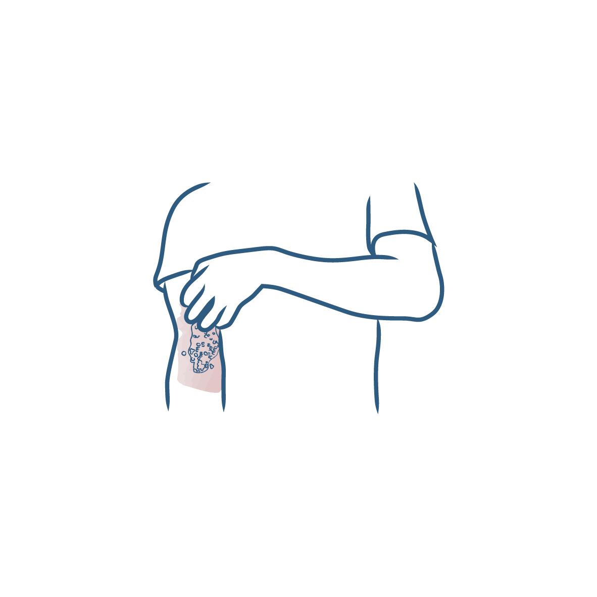 DU_PICTOGRAMS_SKIN-EXPERTISE_07-2020_ECZEMA