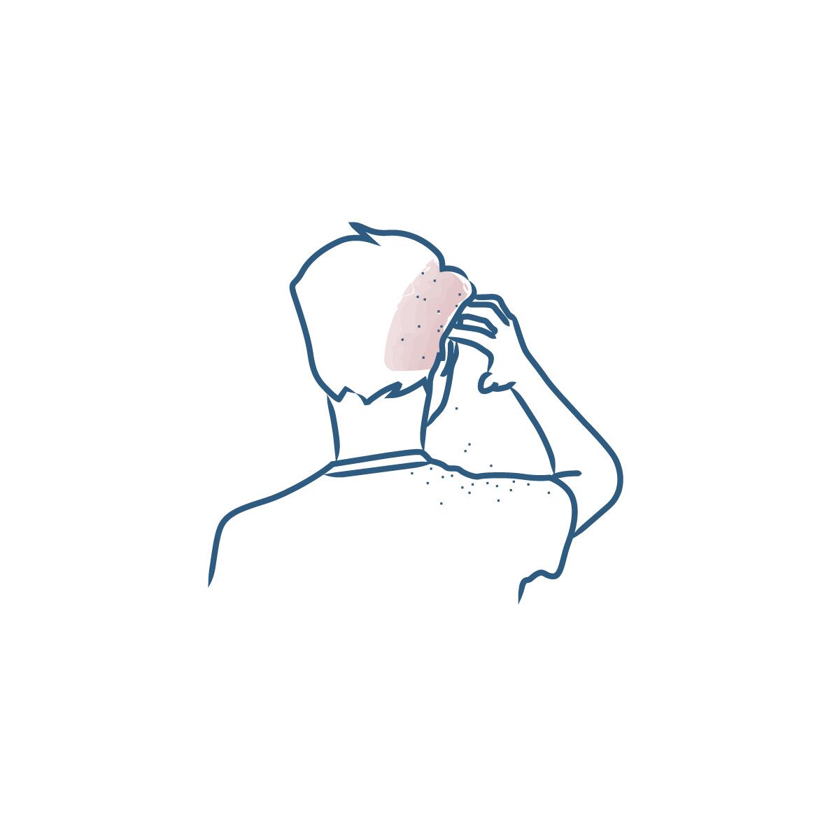 DU_PICTOGRAMS_HAIR-EXPERTISE_07-2020_DANDRUFF