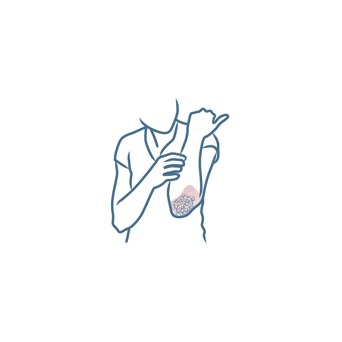 DU_PICTOGRAMS_SKIN-EXPERTISE_07-2020_PSORIASIS