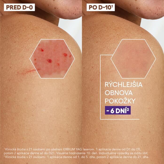 Osvedčená účinnosť Regeneračný krém
