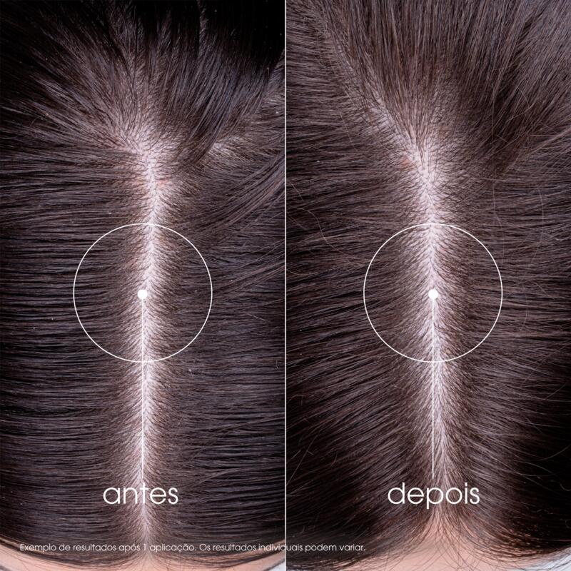 Champô com Ortiga BIO