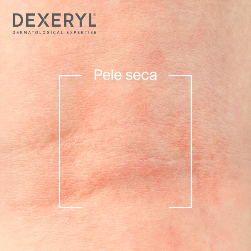Dexeryl Creme Emoliente