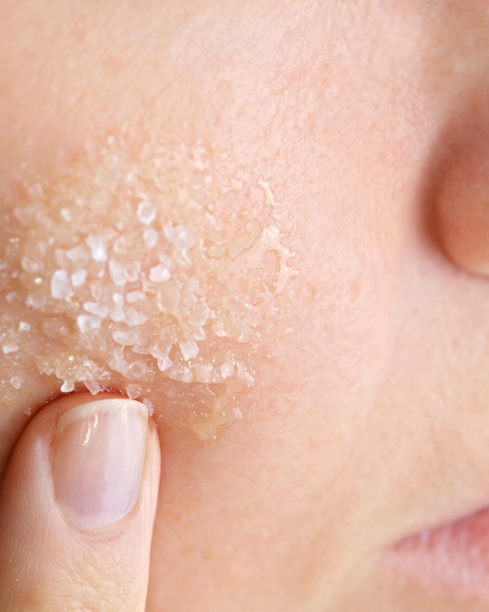 <span class="ezstring-field">av_acne_gommage_4x5</span>