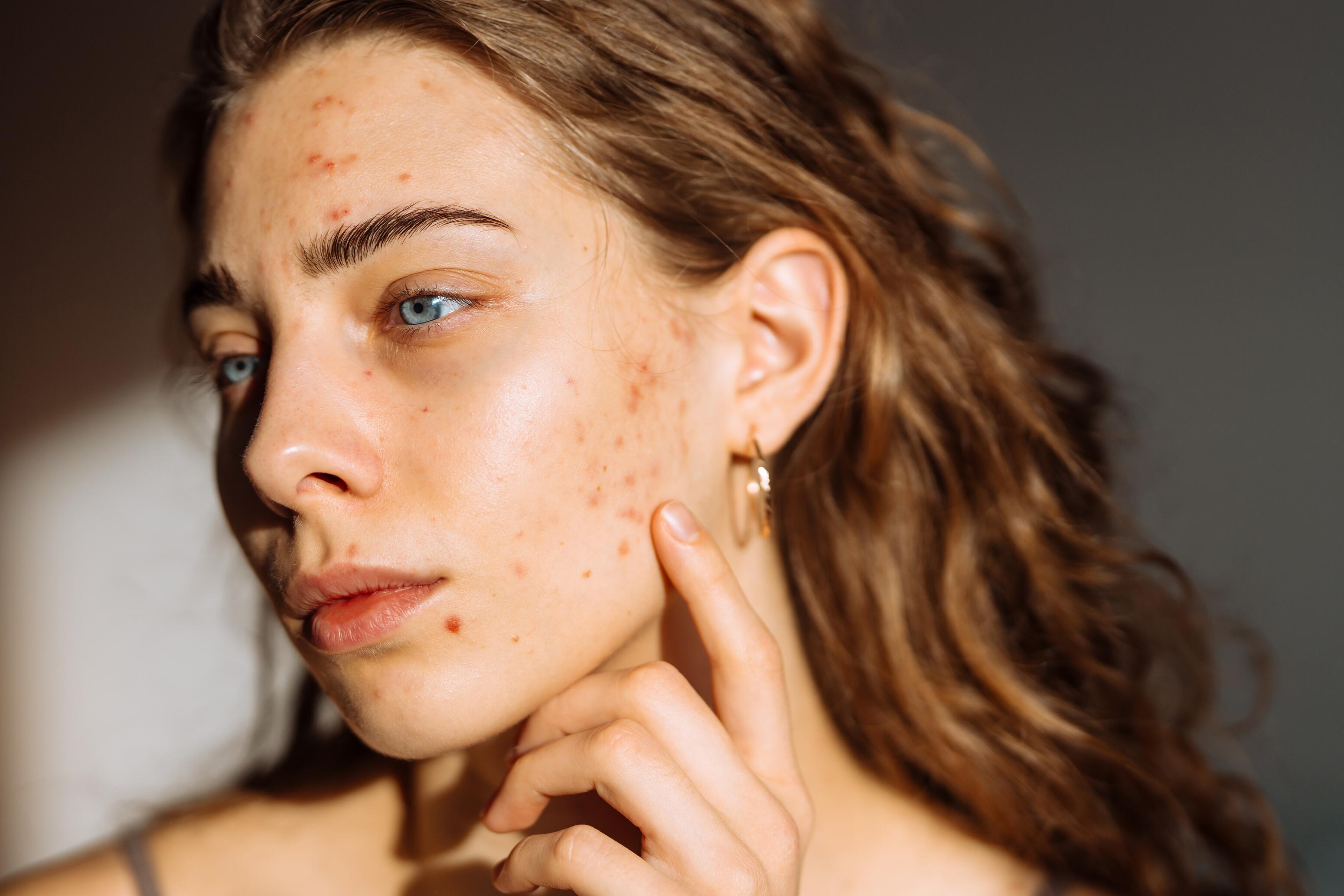 L'Intelligence Artificielle : une nouvelle génération d'études cliniques