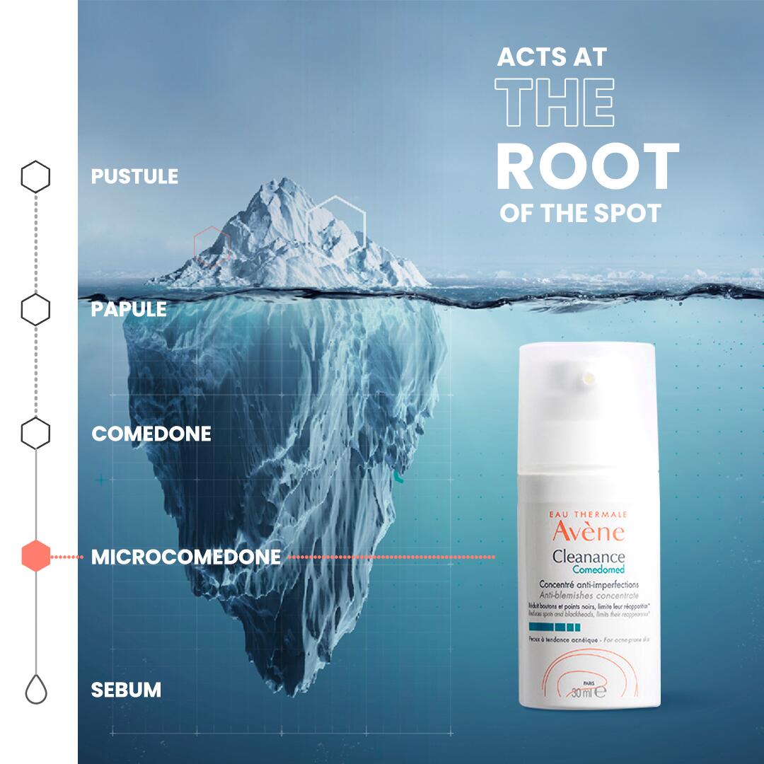 AV_CLEANANCE-COMEDOMED_PPL_AV23_CONSIDERATION_ICEBERG_EN_CA