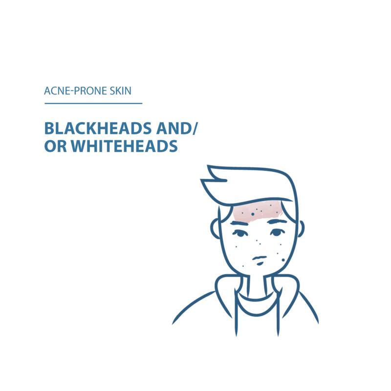 KERACNYL GLYCOLIC+ Anti-Mitesser Creme