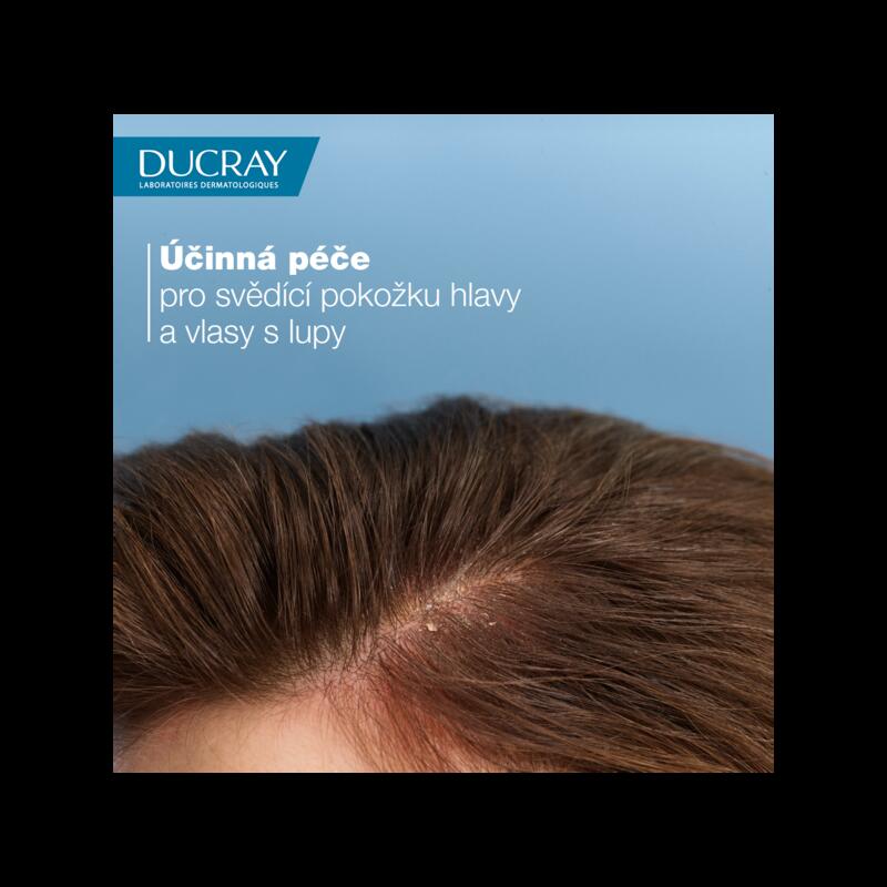 Pečující šampon při závažných stavech lupů