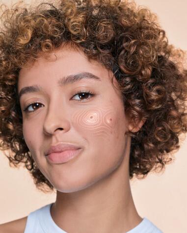 av_acne_push_article_HP_hr_381x485