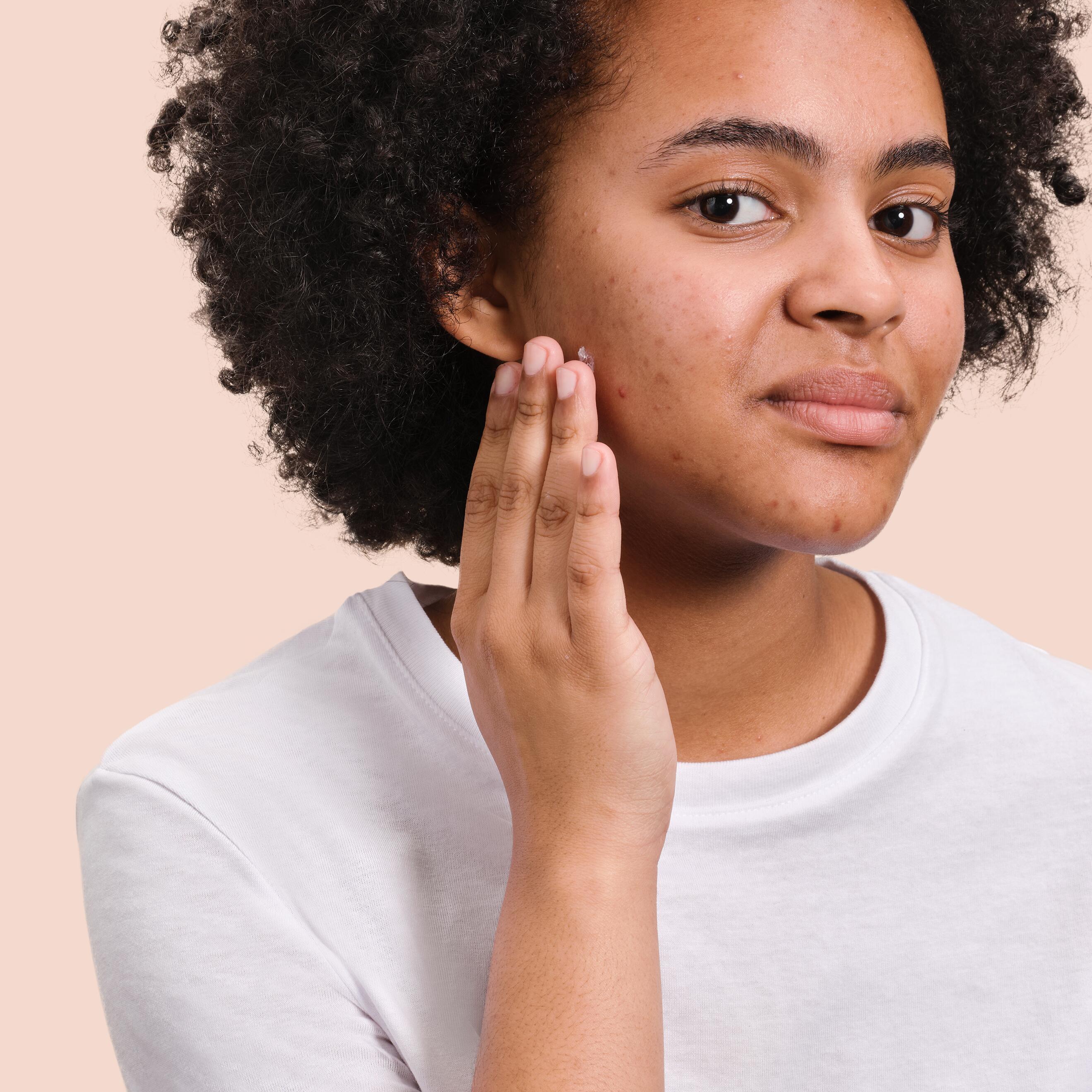 AV_cicalfate-_repairing-protective-cream_3282770204667_ceryse_application-pimples_1x1
