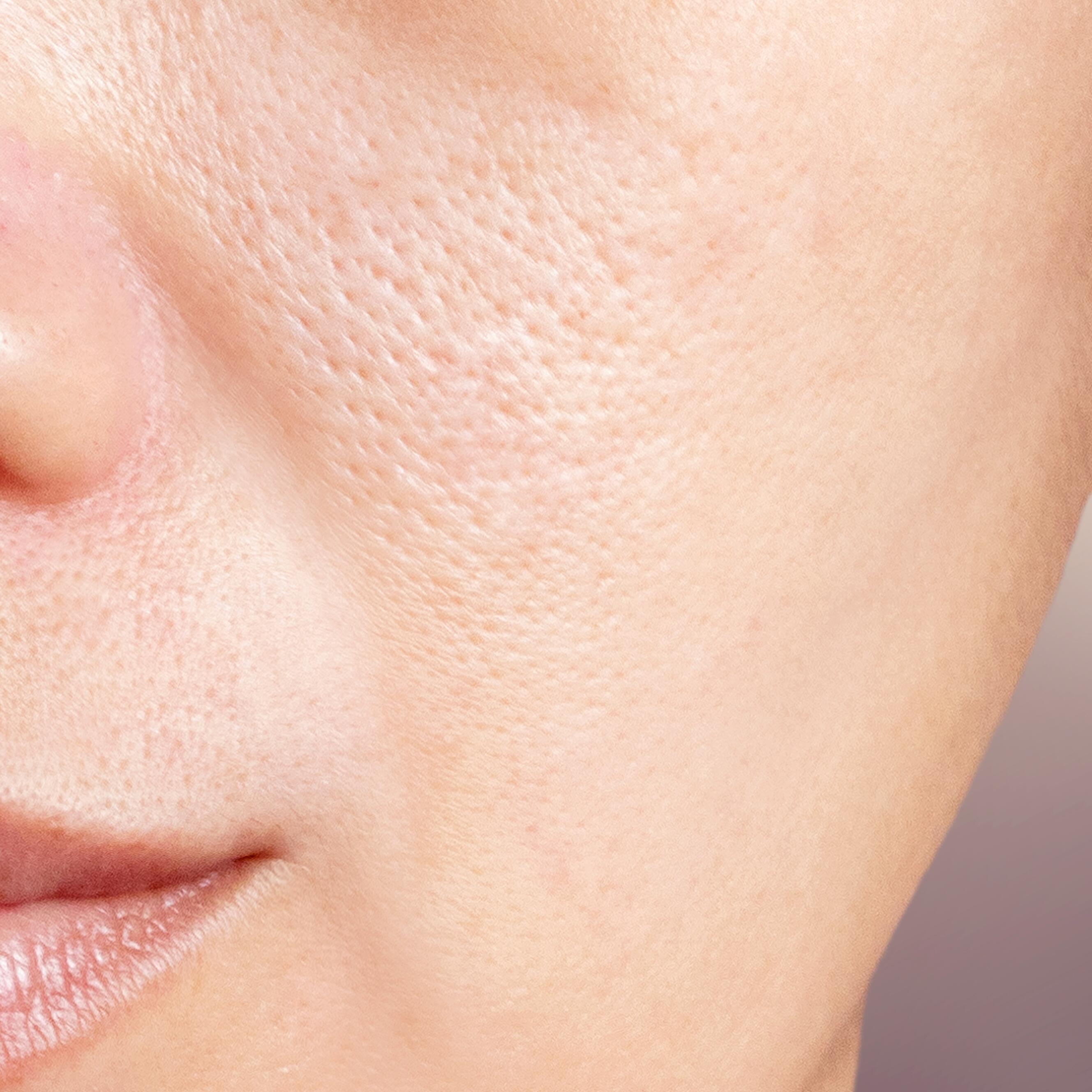 Todo lo que hay que saber sobre los poros de la piel