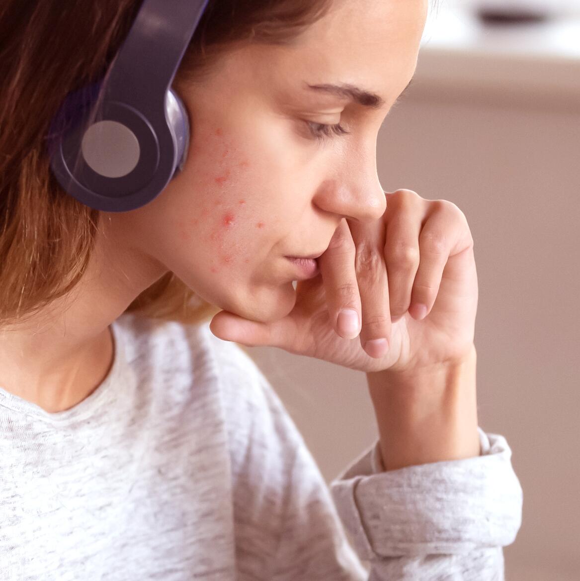 av_acne_inflammatoire_femme_1x1