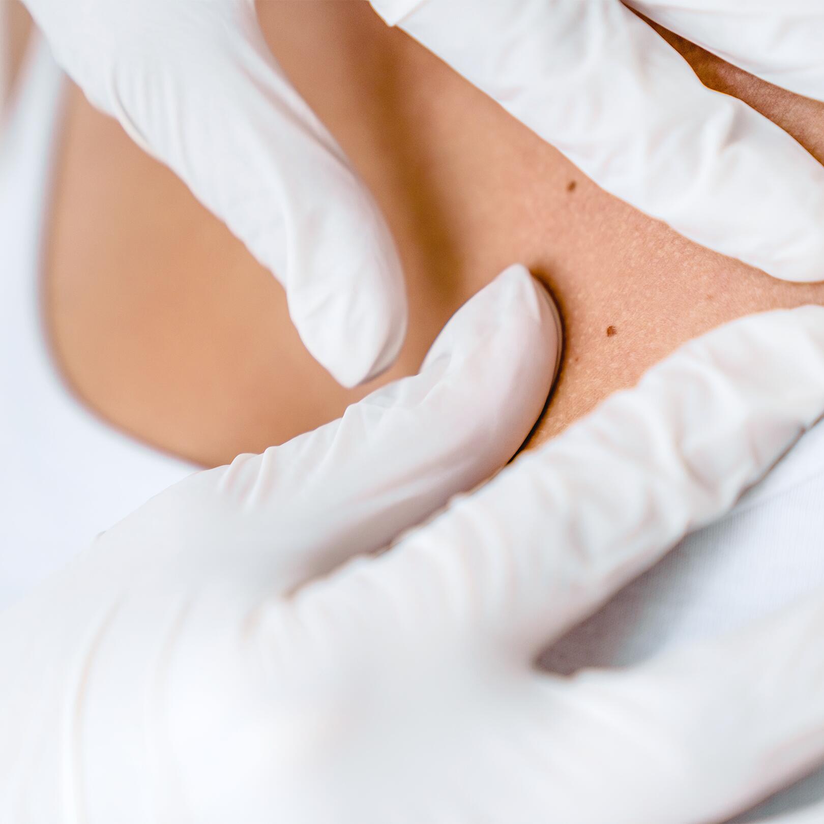 av_peau-cancer_dermatologue_examen_peau_boutons_1x1