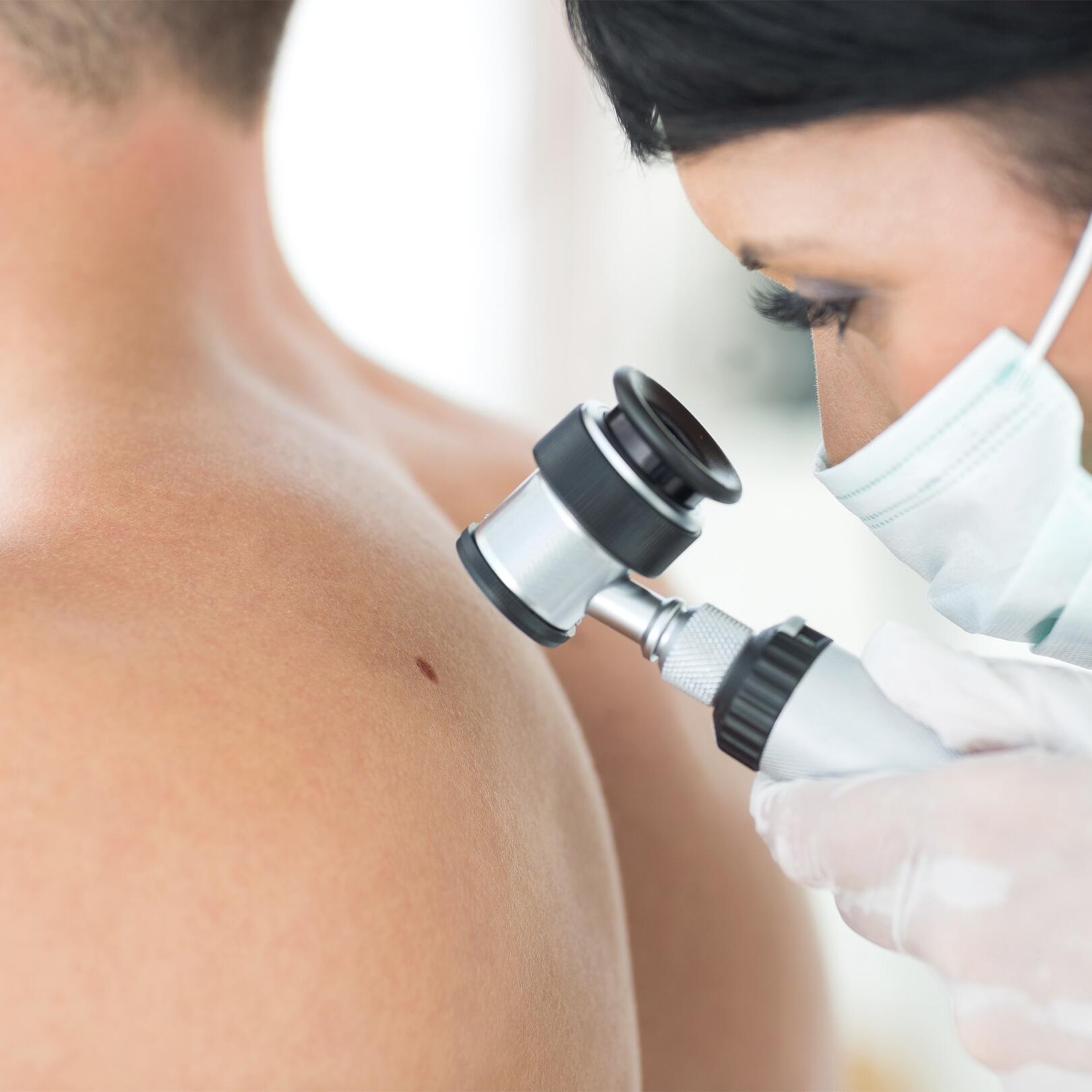 av_peau-cancer_dermatologue_depistage_1x1