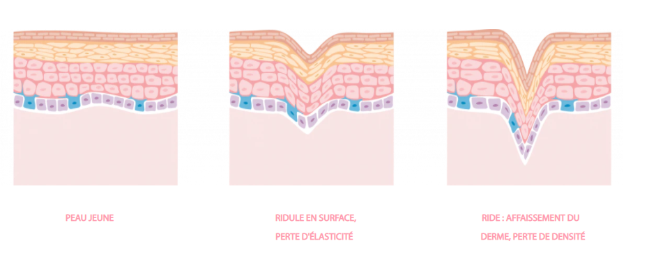 du_article_dry-skin-aging_body1