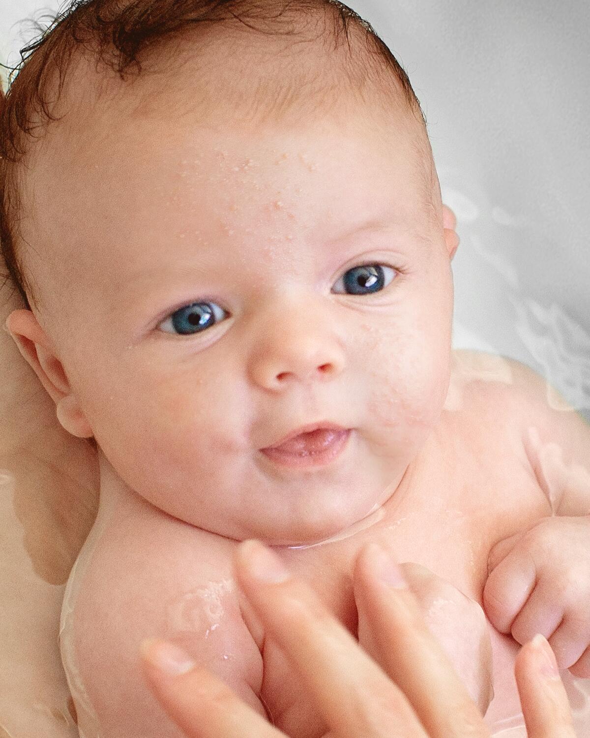 <p><a href="/a-sua-pele/pele-oleosa-com-tendencia-para-manchas-e-acne/o-que-e-pele-com-tendencia-acneica/acne-infantil">Acne em beb&eacute;s&nbsp;</a></p>

