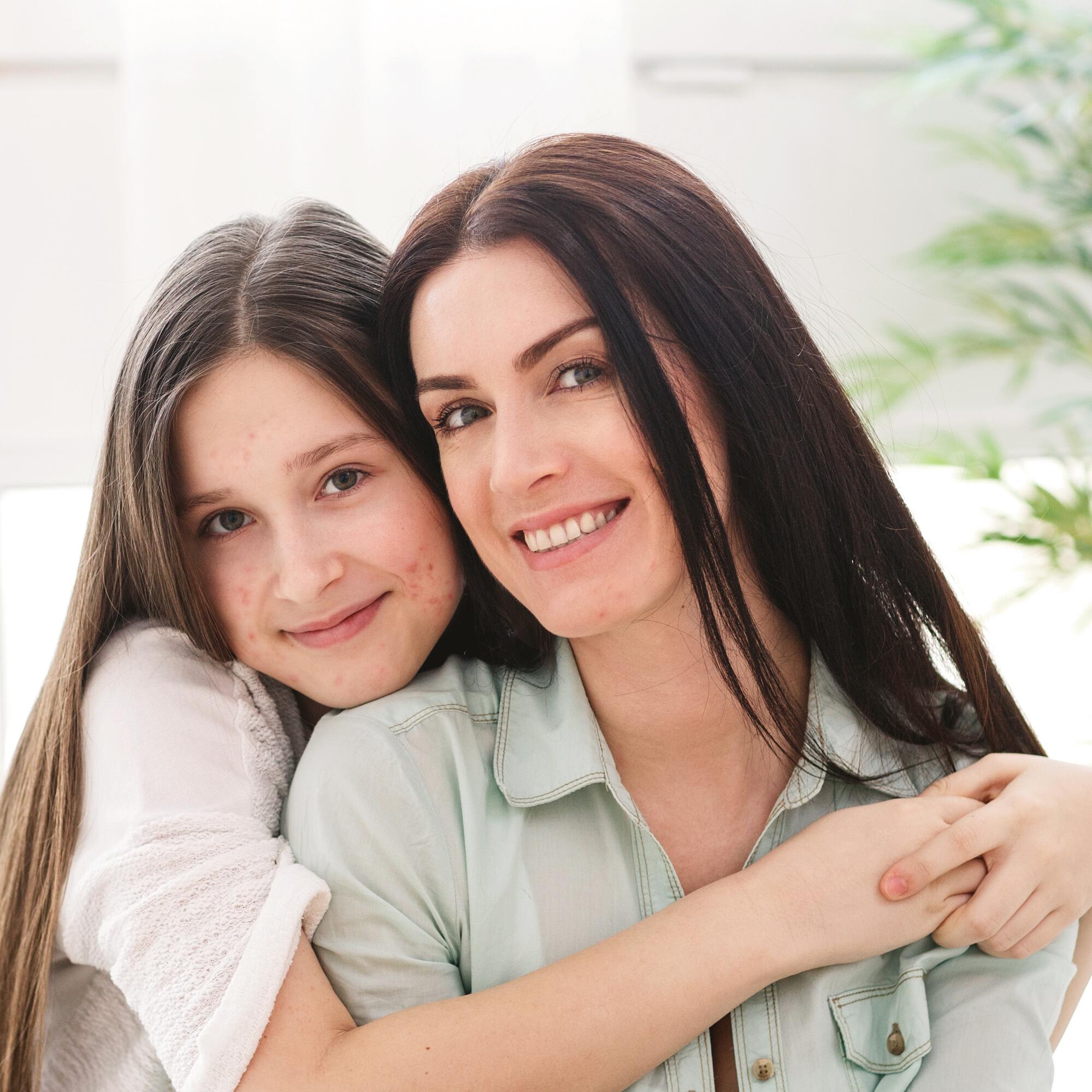 av_acne_adolescent_parent_1x1