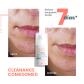 Comedomed Concentrado anti-imperfecciones 