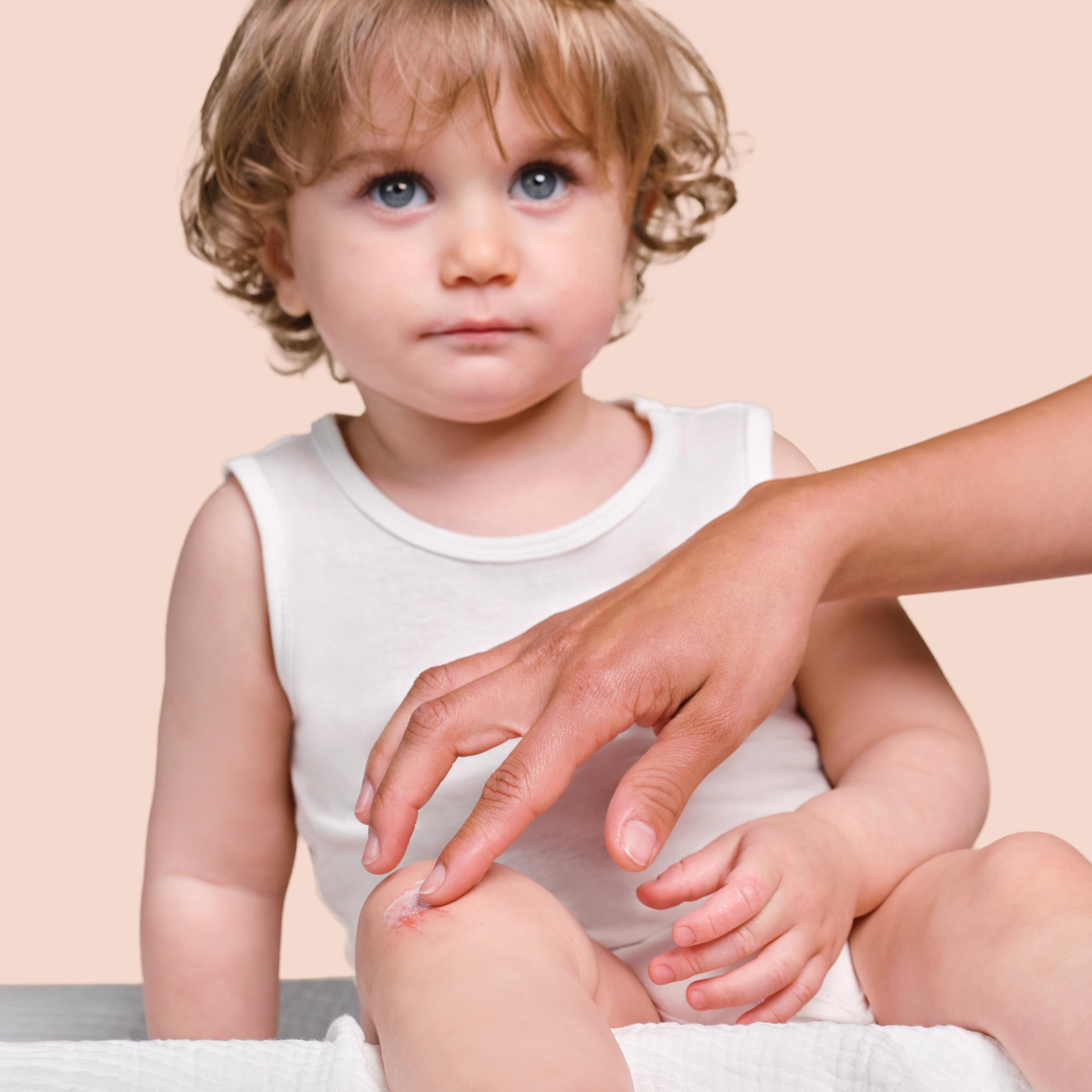 av_votre-peau_cicatrisation_varicelle_reconnaitre_soigner_1x1 473x473