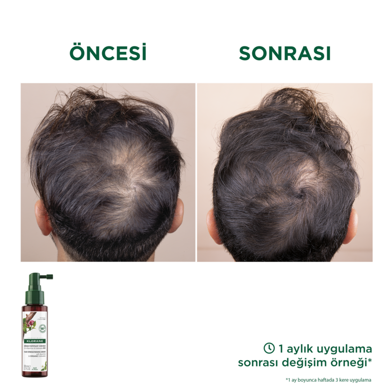 Kinin ve ORGANİK Aşk Çiçeği özleri içerikli Serum