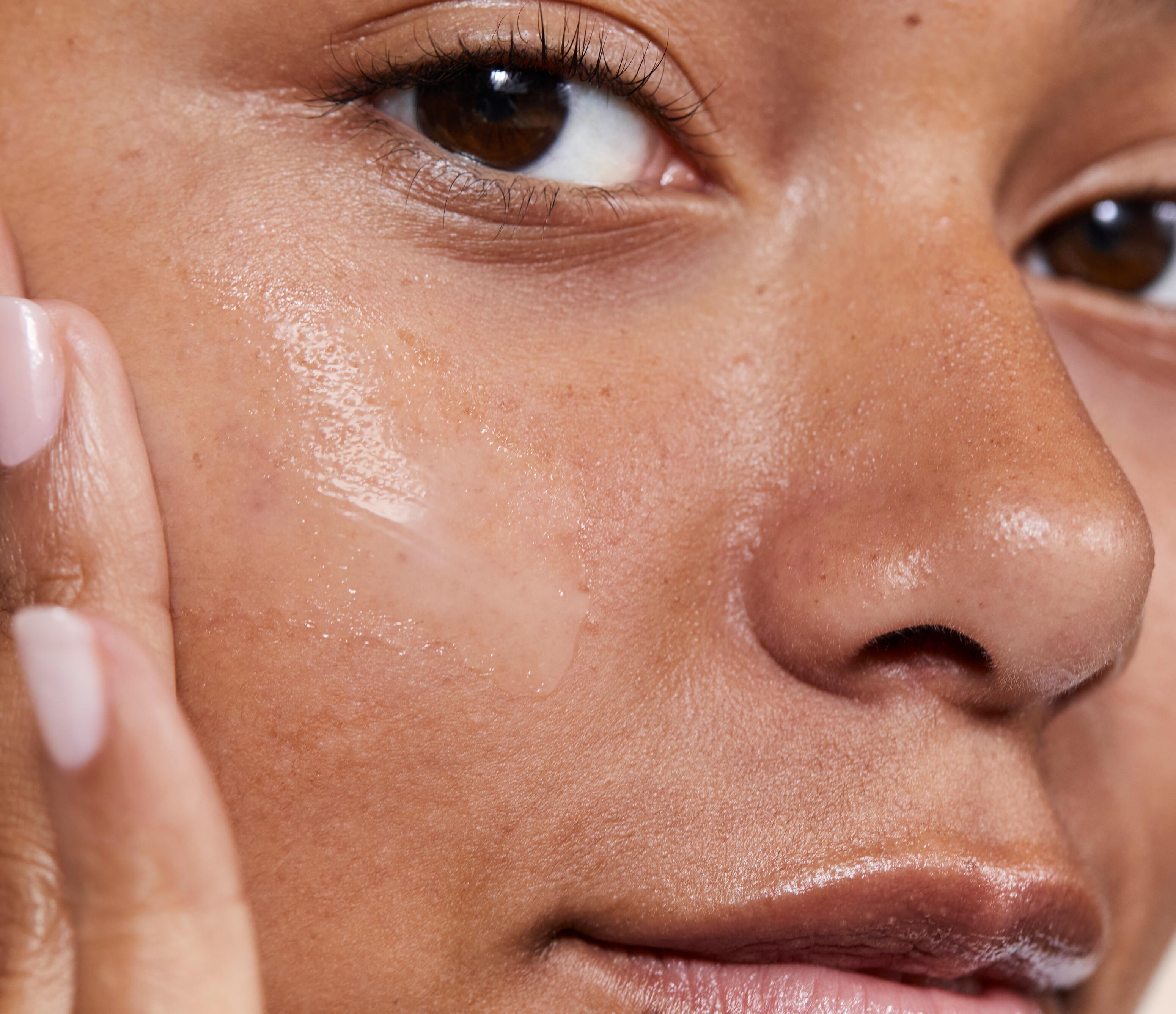 Et si vous vous réconciliez avec votre peau à tendance acnéique ?