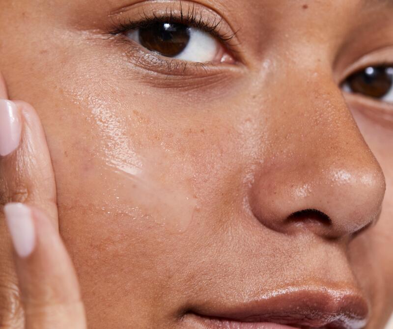 What if you were to make peace with your acne-prone skin?