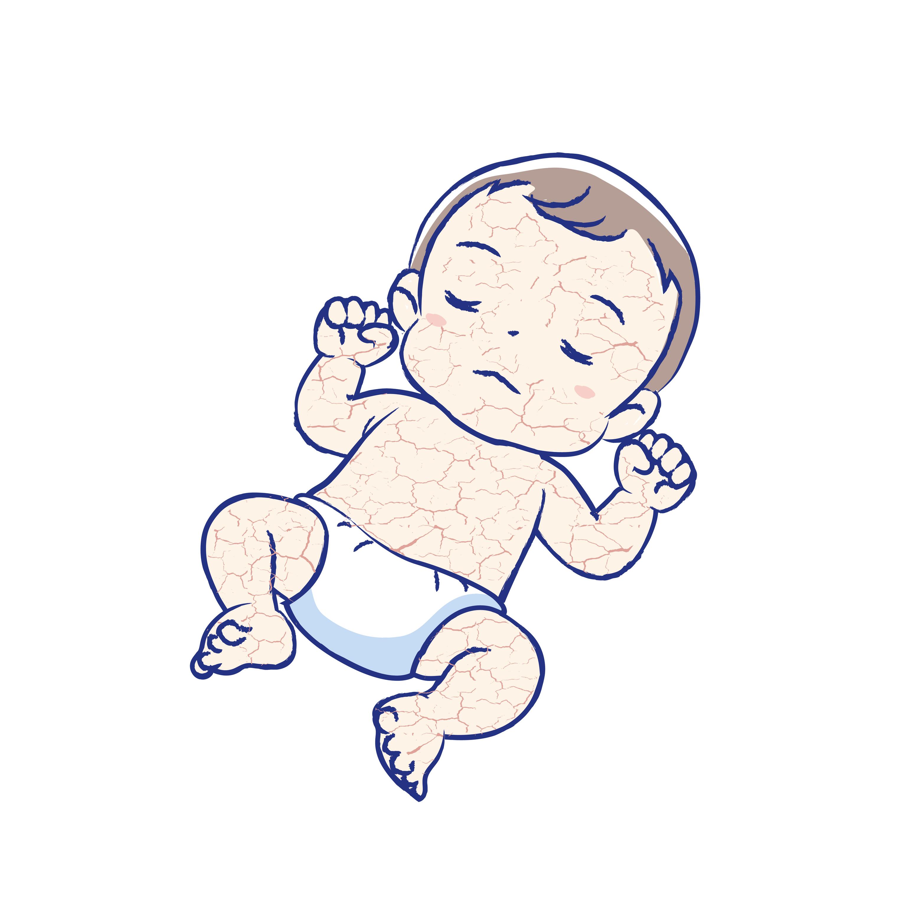 md_dexeryl_website-ichthyosis-image_adobestock_538160028