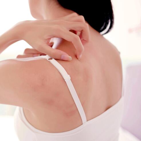 Eczema no abdômen e nas costas