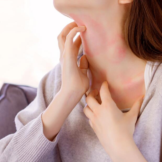 Eczema do rosto e pescoço