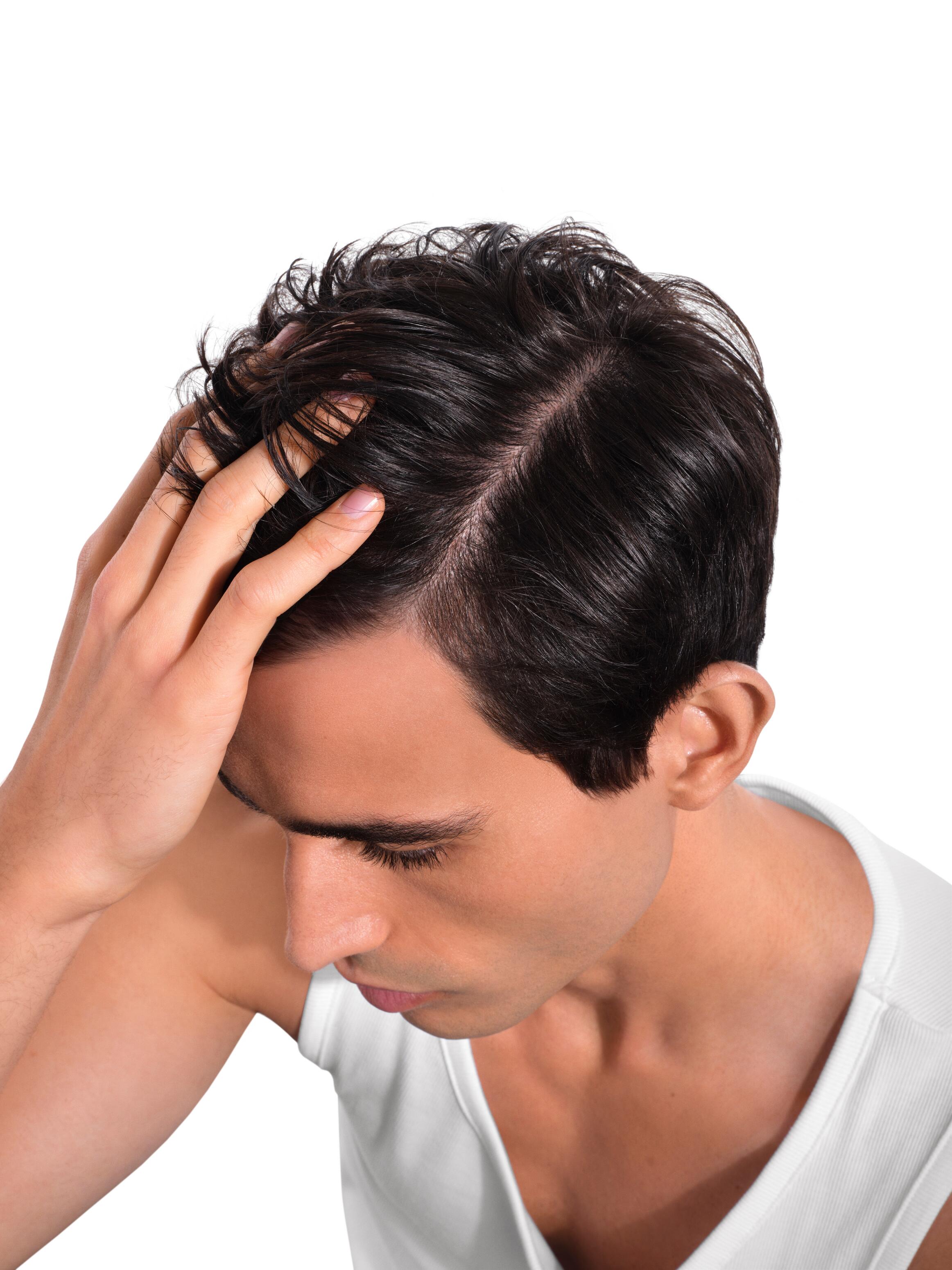 U niektórych osób problem nadmiernej utraty włosów może mieć podłoże genetyczne. Dotyczy to m.in. łysienia androgenowego, które jest najczęstszą przyczyną wypadania włosów u mężczyzn.