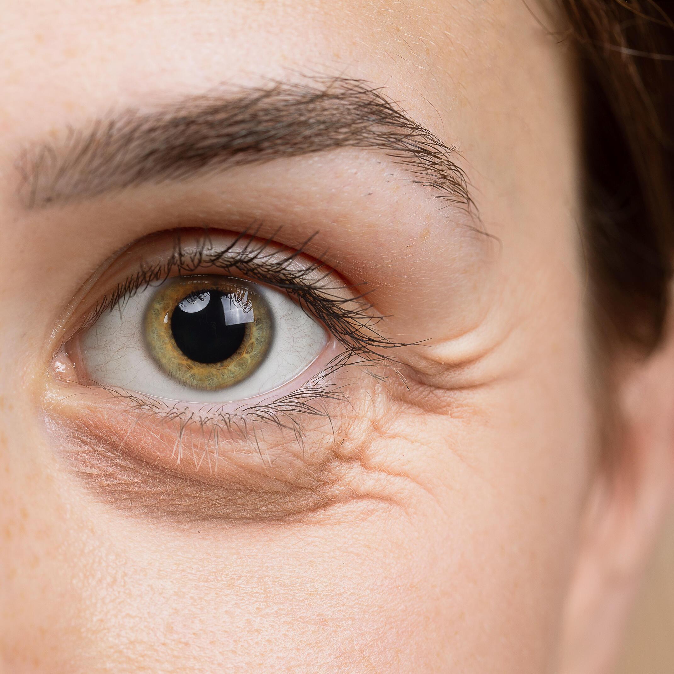 Pielęgnacja przeciwzmarszczkowa: od pierwszych linii mimicznych po utrwalone bruzdy